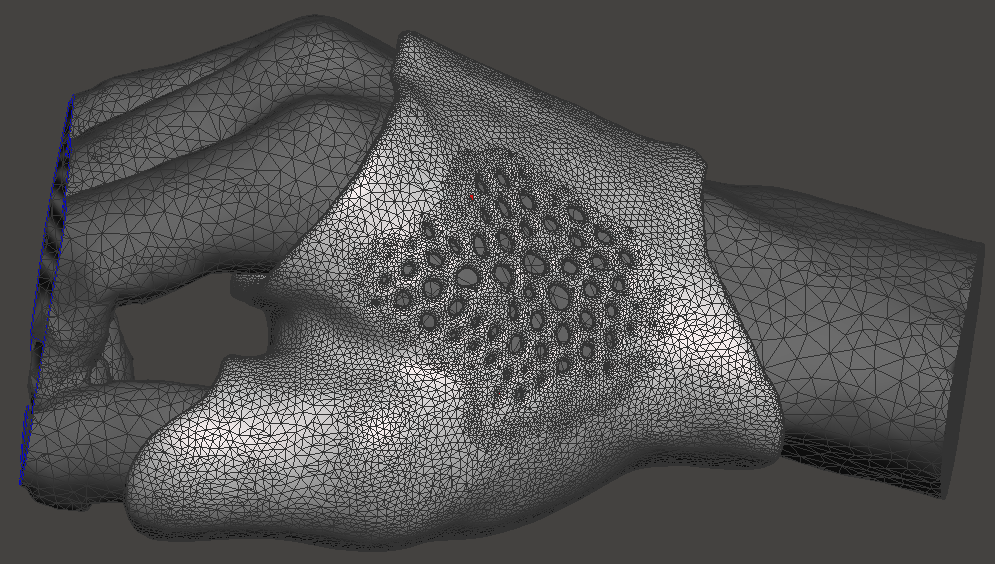 The finished splint model