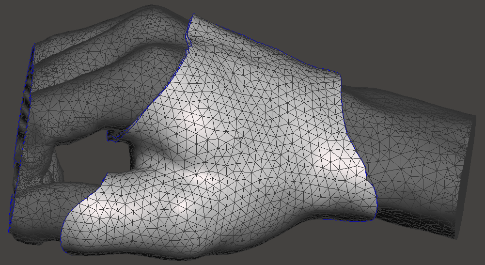 Modelling inner and outer layers of the splint