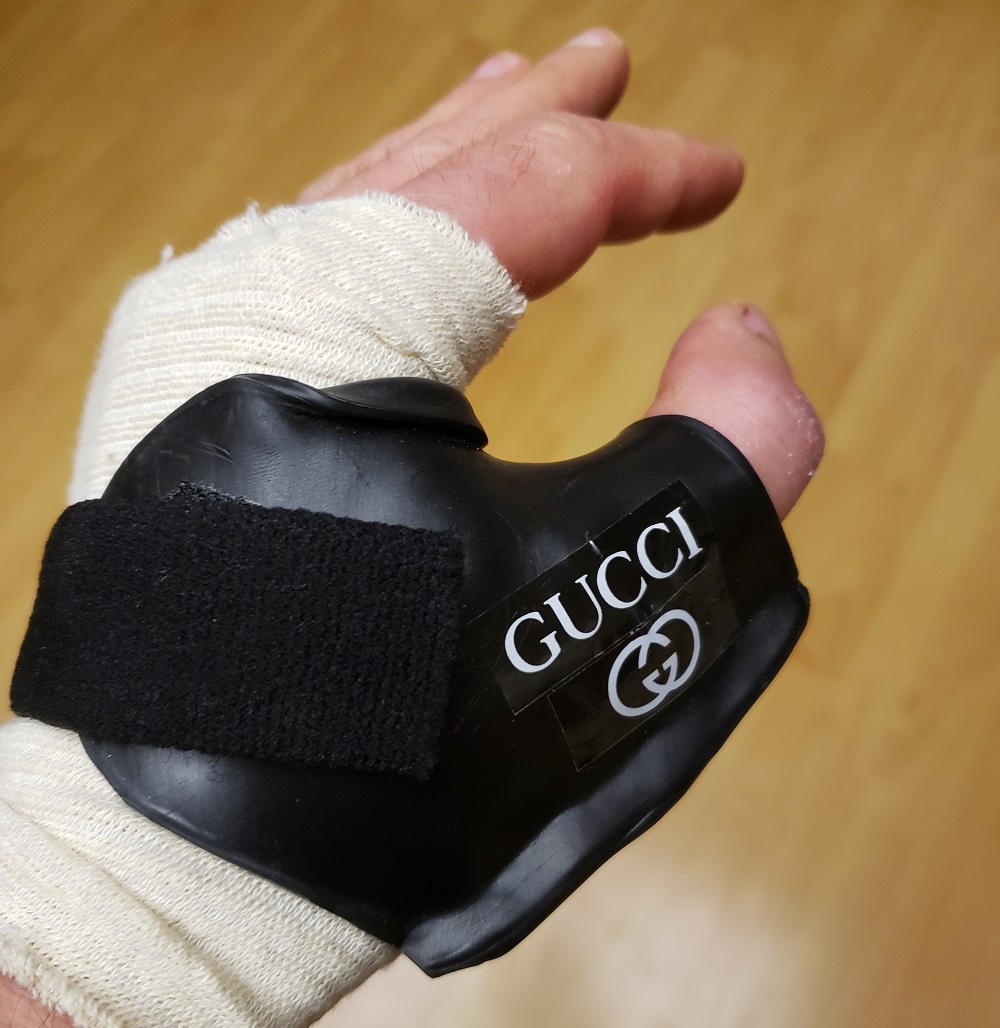 The original hand splint